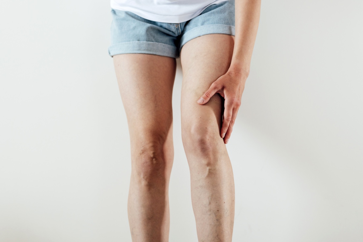 zatrzymanie wody w organizmie